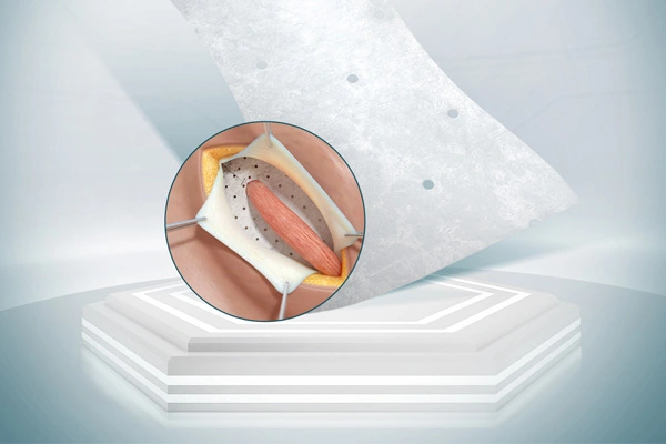 Sản phẩm sinh học cho phẫu thuật tổng quát