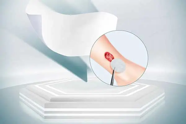 Sản phẩm quản lý vết thương