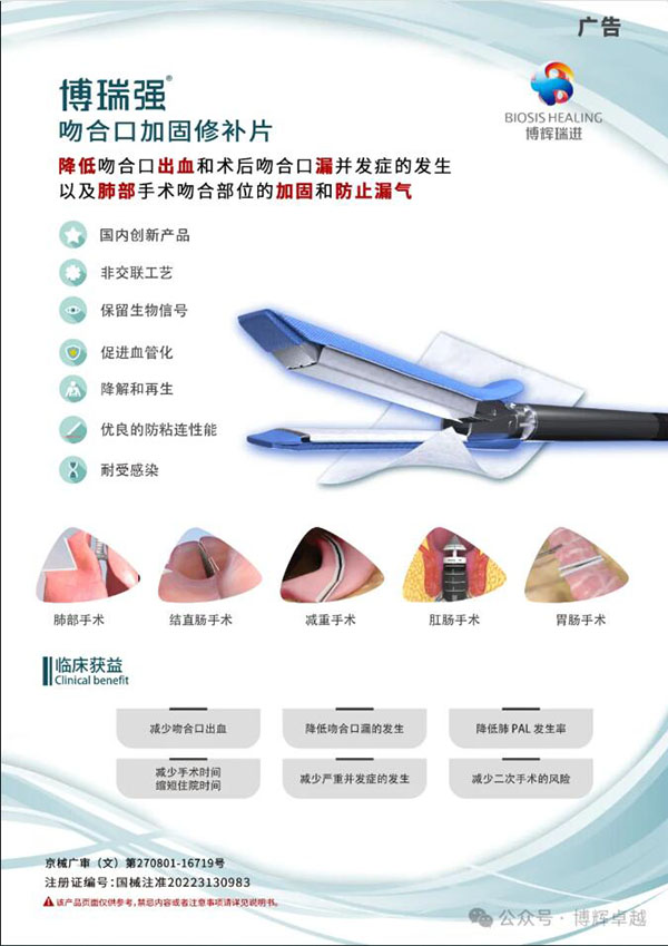 aparoscopic trocar factory 