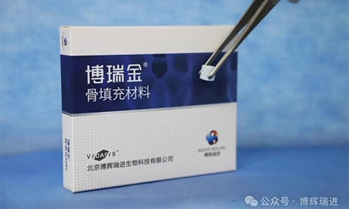 Sản phẩm vật liệu Ghép Xương vidasis chính thức được chứng nhận, và gia đình Miệng chữa bệnh bằng Biosis chào đón một sản phẩm khác