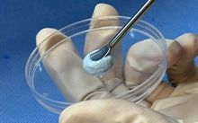 Vật liệu Ghép Xương